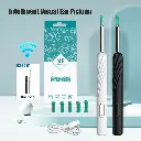 Wireless Visual Earpick.webp